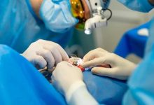 Hukum Wasiat Donor Mata